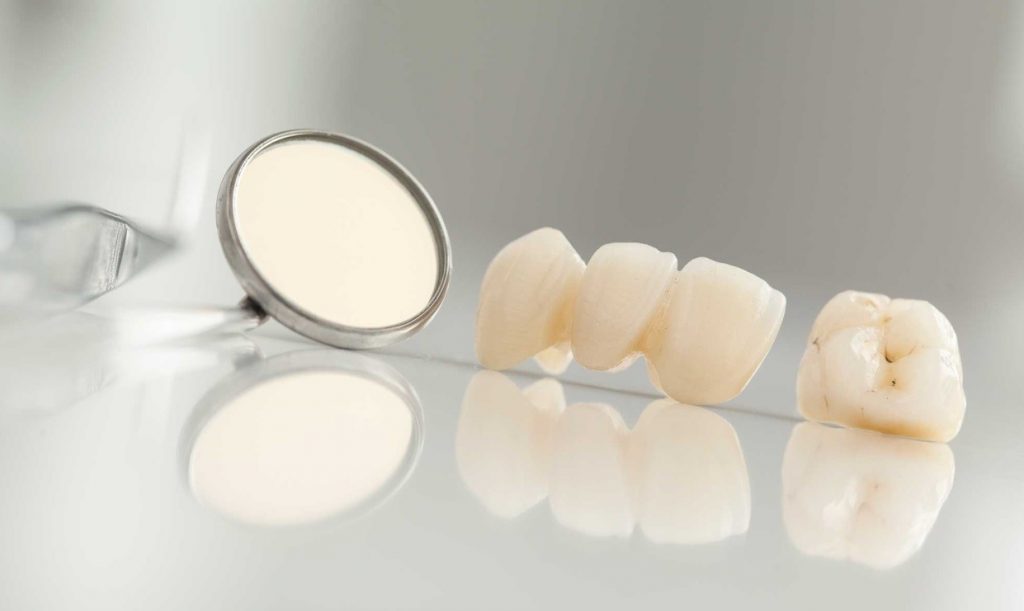 روکش دندان در خوی پروتز دندان در خوی دکتر نگین واعظی روکش دندان در خوی لمینت سرامیکی در خوی