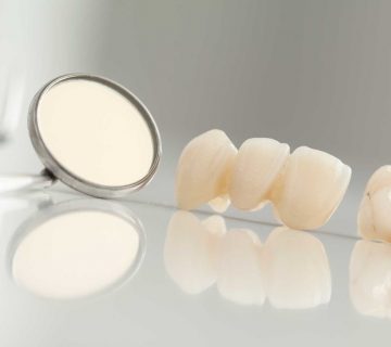 روکش دندان در خوی پروتز دندان در خوی دکتر نگین واعظی روکش دندان در خوی لمینت سرامیکی در خوی