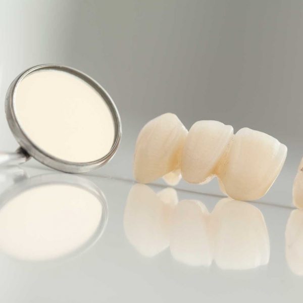 روکش دندان در خوی پروتز دندان در خوی دکتر نگین واعظی روکش دندان در خوی لمینت سرامیکی در خوی