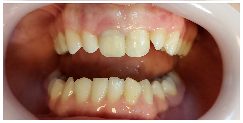 دندانپزشکی زیبایی و طرح لبخند در خوی دکتر نگین واعظی