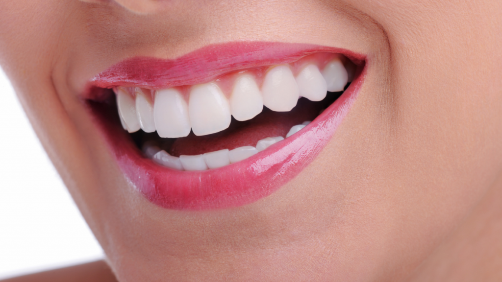 می خواهم لبخند زیباتری داشته باشم، لمینیت سرامیکی برایم بهتر است یا ونیر کامپوزیت یا بلیچینگ