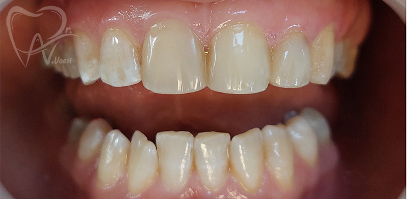 دندانپزشک ترمیمی و زیبایی در خوی دکتر نگین واعظی متخصص دندانپزشکی زیبایی در خوی