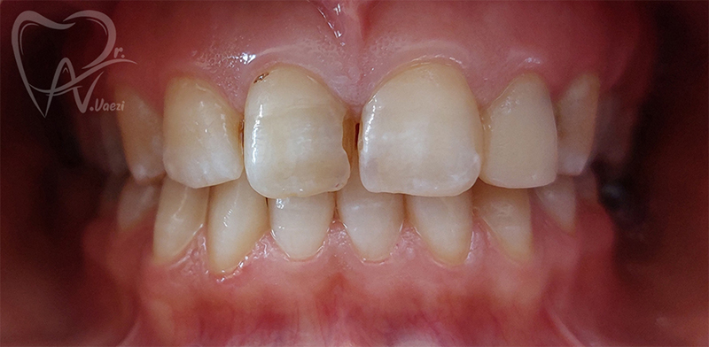 دندانپزشکی زیبایی در خوی بهترین دندانپزشک در خوی دندانپزشک خانم در خوی دندانپزشک خوب زیبایی در خوی زیبا کردن دندان ها در خوی