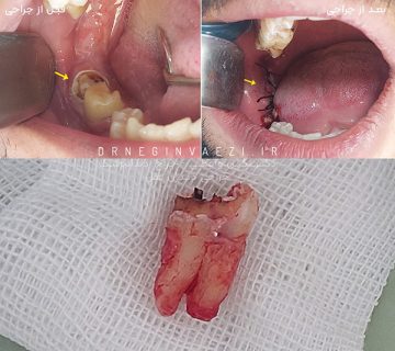 بهترین جراح فک و صورت در تبریز نی نی سایت متخصص کشیدن دندان در تبریز جراحی چانه تبریز جراحی دندان عقل لیست جراح دندانپزشک تبریز جراح فک و صورت بیمارستان محلاتی تبریز متخصص دندان عقل دندان پزشک خوب در تبریز