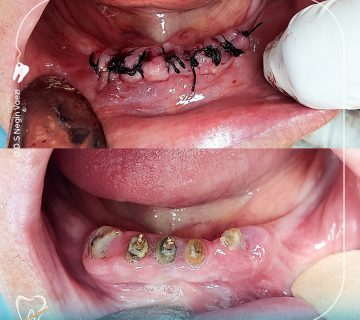 دکتر نگین واعظی جراح و دندانپزشک در تبریز خارج‌سازی دندان دندان غیر قابل نگهداری جراحی دندان عفونت دندان پوسیدگی دندان مشکلات لثه دندانپزشکی درمان دندان ایمپلنت دندان پروتز دندانی بهداشت دهان و دندان درد دندان شکستگی دندان درمان عفونت دندان هزینه خارج‌سازی دندان