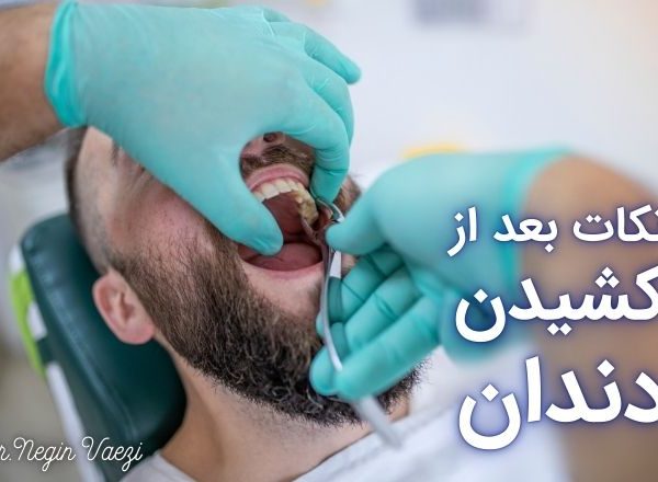 مراقبت‌های بعد از کشیدن دندان کشیدن دندان در تبریز بهترین دندانپزشک تبریز مراقبت دهان بعد از کشیدن دندان درد بعد از کشیدن دندان ورم بعد از کشیدن دندان عفونت بعد از کشیدن دندان خونریزی بعد از کشیدن دندان کشیدن دندان عقل در تبریز رعایت بهداشت دهان بعد از کشیدن دندان زمان بهبودی بعد از کشیدن دندان غذاهای مناسب بعد از کشیدن دندان پیشگیری از خشکی ساکت دندان خدمات دندانپزشکی در تبریز هزینه کشیدن دندان در تبریز
