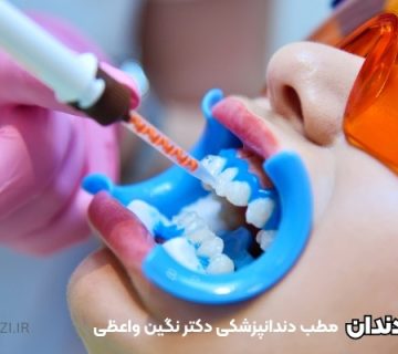 بلیچینگ دندان در تبریز - هزینه بلیچینگ دندان در تبریز - دکتر دندانپزشک خانم برای سفید کردن دندان در تبریز ولیعصر بلیچینگ ارزان در تبریز