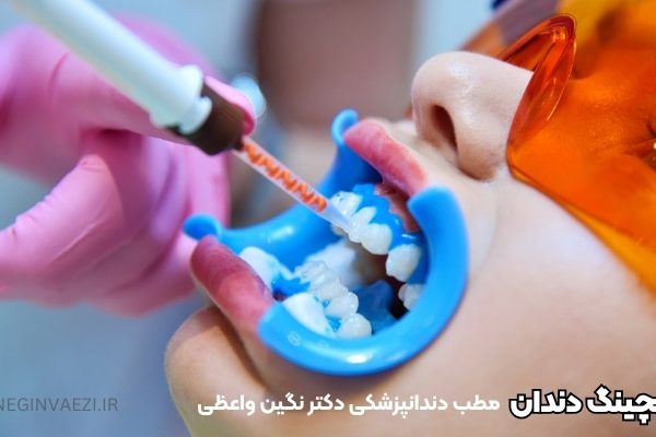 بلیچینگ دندان در تبریز - هزینه بلیچینگ دندان در تبریز - دکتر دندانپزشک خانم برای سفید کردن دندان در تبریز ولیعصر بلیچینگ ارزان در تبریز