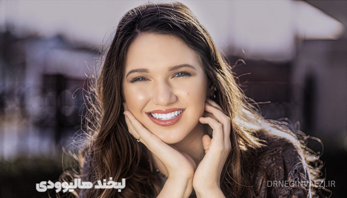لبخند هالیوودی چیست   قیمت لبخند هالیوودی   لبخند هالیوودی تبریز ولیعصر   طراحی لبخند هالیوودی
