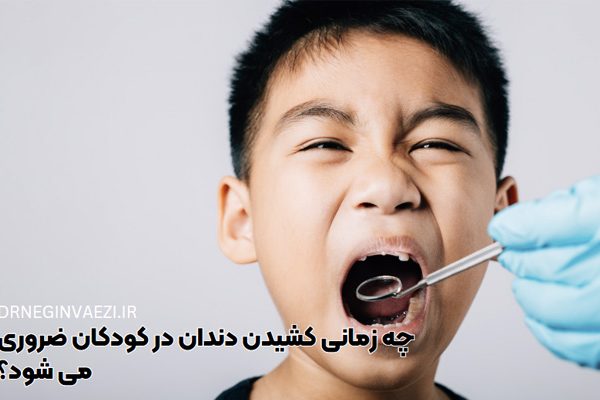 کشیدن دندان کودکان چه زمانی ضروری است؟ مراقبت های بعد از کشیدن دندان کودک - راضی کردن کودک برای کشیدن دندان