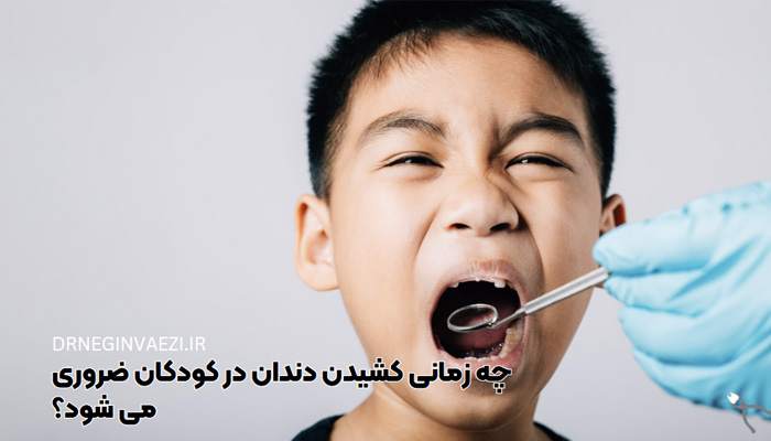 کشیدن دندان کودکان چه زمانی ضروری است؟ مراقبت های بعد از کشیدن دندان کودک - راضی کردن کودک برای کشیدن دندان