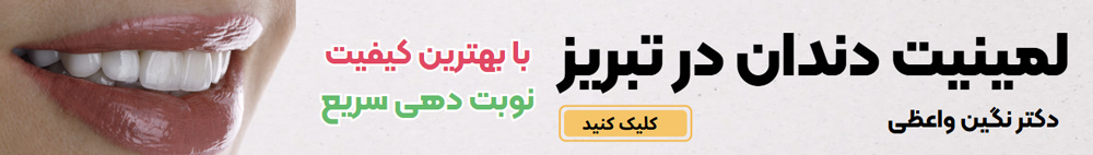 لمینت دندان در تبریز