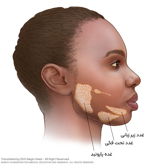 خشکی دهان Dry mouth یا xerostomia زروستومیا چیست، علت ، علایم ، روش های تشخیص و درمان در تبریز