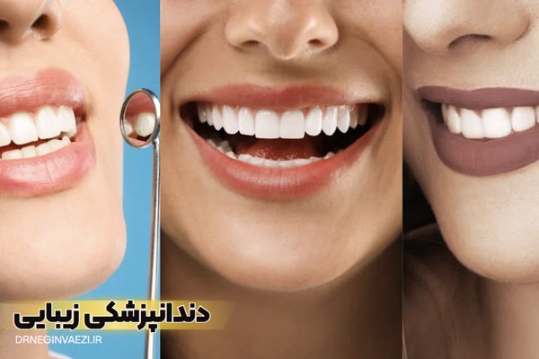 ونیر دندان سرامیکی تبریز,بهترین دندانپزشک زیبایی ایمپلنت تبریز,دندانپزشکی زیبایی تبریز,کامپوزیت زیبایی دندان ها تبریز,بلیچینگ دندان تبریز,ونیر کامپوزیت دندان تبریز,بهترین دندانپزشک زیرکونیا تبریز