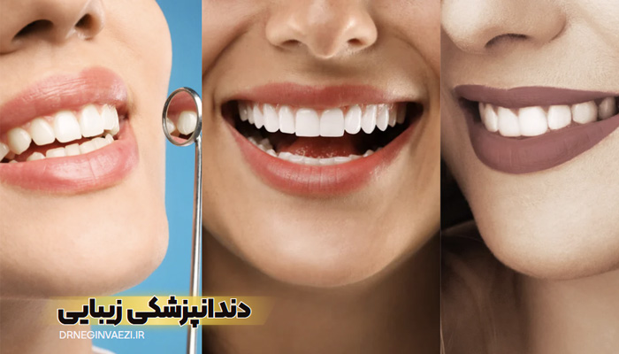 ونیر دندان سرامیکی تبریز,بهترین دندانپزشک زیبایی ایمپلنت تبریز,دندانپزشکی زیبایی تبریز,کامپوزیت زیبایی دندان ها تبریز,بلیچینگ دندان تبریز,ونیر کامپوزیت دندان تبریز,بهترین دندانپزشک زیرکونیا تبریز