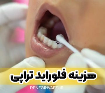 هزینه فلوراید تراپی و قیمت فلوراید تراپی و شرایط رایگان آن در تبریز
