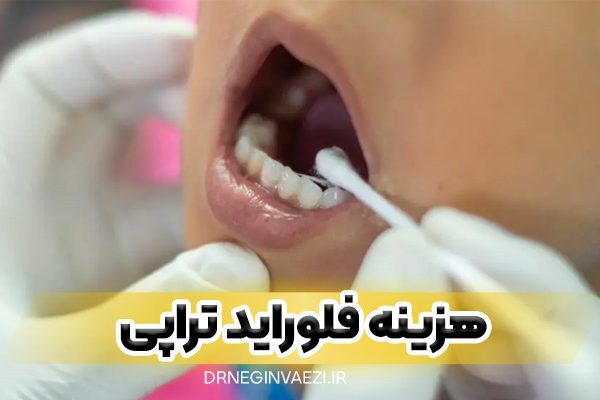 هزینه فلوراید تراپی و قیمت فلوراید تراپی و شرایط رایگان آن در تبریز