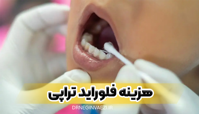 هزینه فلوراید تراپی و قیمت فلوراید تراپی و شرایط رایگان آن در تبریز