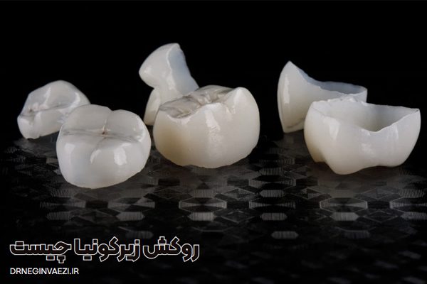 روکش زیرکونیا چیست