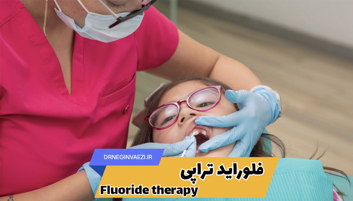 فلوراید تراپی کودکان چگونه است؟ فلورایدتراپی برای پیشگیری از پوسیدگی دندان کودکان در تبریز - فواید فلوراید - مقالات معتبر درباره فلوراید و مضرات آن - فلوئوروزیس