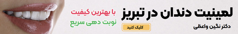 لمینت دندان در تبریز