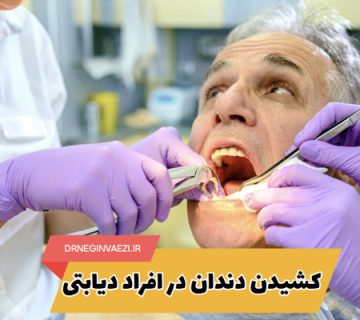 راهنمای کامل کشیدن دندان در بیماران دیابتی: آمادگی، مراقبت ها، کاهش ریسک عفونت و نکات حیاتی برای بهبودی سریع‌تر | معرفی دندانپزشک در تبریز