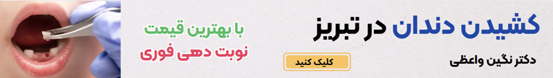 کشیدن دندان در تبریز نوبت دهی فوری با قیمت ارزان بهترین قیمت بهترین دکتر کشیدن دندان عفونی
