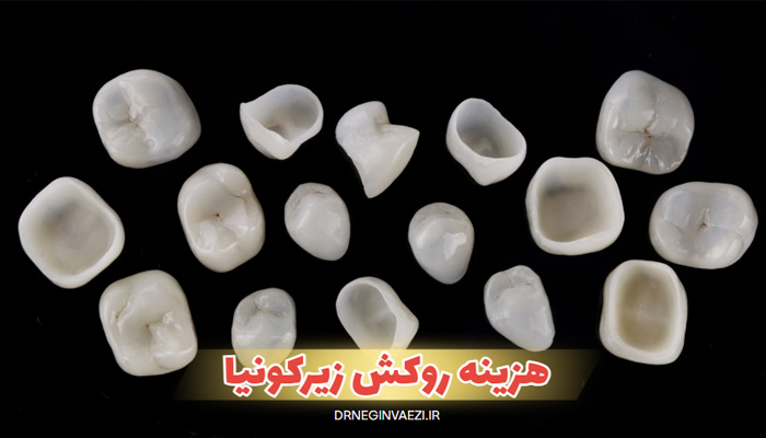 قیمت روکش دندان سرامیکی در تبریز هزینه روکش دندان عصب کشی شده قیمت روکش دندان زیرکونیا تبریز نمونه کار روکش زیرکونیا لیست قیمت روکش دندان هزینه روکش دندان با بیمه تامین اجتماعی قیمت روکش دندان جلو 1404 قیمت روکش دندان 1405