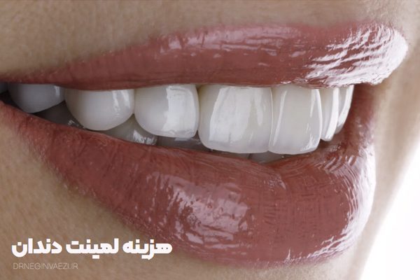 قیمت هر واحد لمینیت دندان در تبریز قیمت لمینت دندان تبریز هزینه لمینت دندان در تبریز لمینت ارزان در تبریز بهترین دکتر لمینت دندان در تبریز