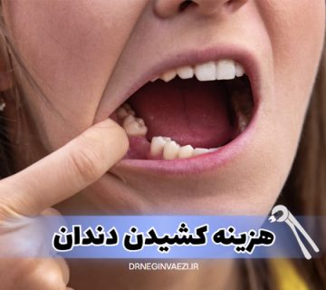 اگر به دنبال هزینه کشیدن دندان در تبریز در سال ۱۴۰۴ هستید، این مقاله راهنمای کامل قیمت ها، انواع کشیدن دندان، نکات مراقبتی و آدرس مطب دندانپزشکی ما را در اختیارتان قرار می‌دهد.