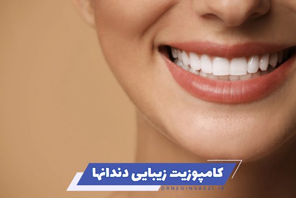 کامپوزیت زیبایی دندانها در تبریز و معرفی بهترین دندانپزشک ونیر کامپوزیت در ولیعصر تبریز برای اصلاح طرح لبخند و بازسازی دندان ها در دندانپزشکی زیبایی