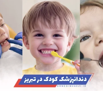 بهترین دندانپزشک کودک در تبریز + جدول تعرفه / هزینه و خدمات دندانپزشکی کودکان در تبریز برای دندان های شیری