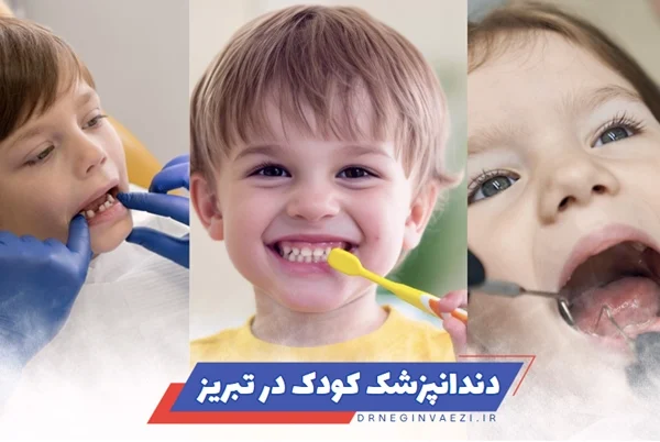 بهترین دندانپزشک کودک در تبریز + جدول تعرفه / هزینه و خدمات دندانپزشکی کودکان در تبریز برای دندان های شیری