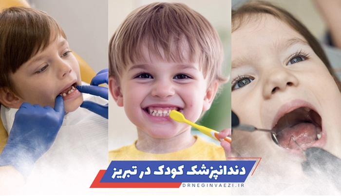 بهترین دندانپزشک کودک در تبریز + جدول تعرفه / هزینه و خدمات دندانپزشکی کودکان در تبریز برای دندان های شیری