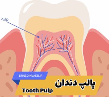 پالپ دندان یا مغز دندان چیست؟ علائم التهاب، درمان عفونت و روش‌های عصب‌کشی با حفظ دندان در تبریز