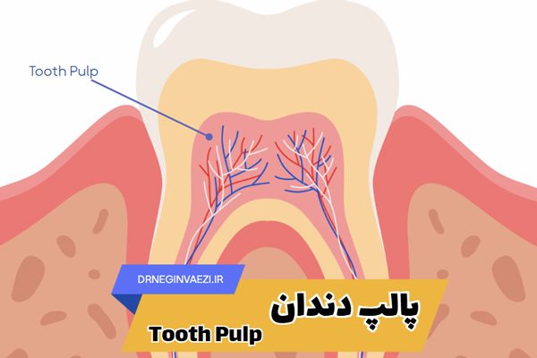 پالپ دندان یا مغز دندان چیست؟ علائم التهاب، درمان عفونت و روش‌های عصب‌کشی با حفظ دندان در تبریز
