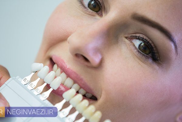 ۵ اشتباه رایج بعد از ونیر کامپوزیت دندان که باعث شکست درمان می‌شود