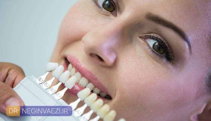 ۵ اشتباه رایج بعد از ونیر کامپوزیت دندان که باعث شکست درمان می‌شود