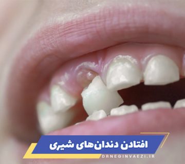 اولین دندان لق کودک کی می‌افتد؟ ترتیب افتادن دندان های شیری کودک