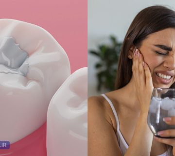 حساس شدن دندان بعد از کامپوزیت هنگام خوردن غذاهای سرد یا گرم