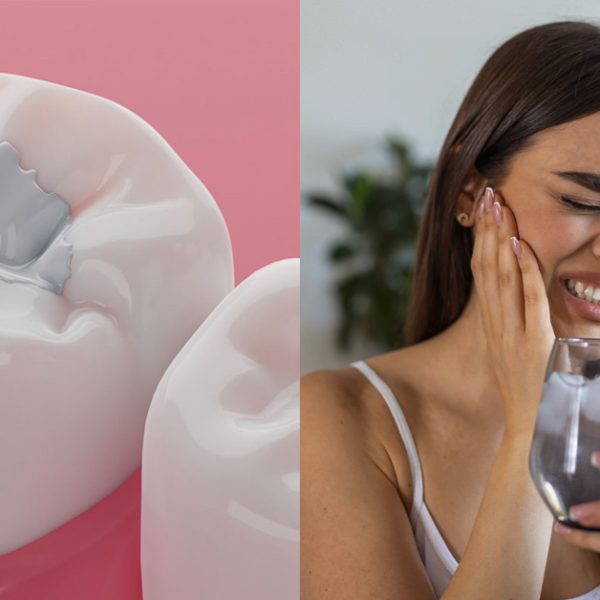 حساس شدن دندان بعد از کامپوزیت هنگام خوردن غذاهای سرد یا گرم