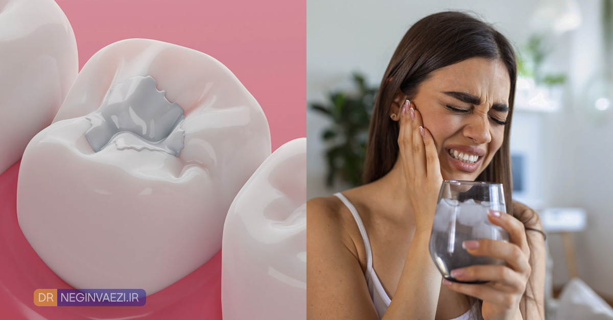 حساس شدن دندان بعد از کامپوزیت هنگام خوردن غذاهای سرد یا گرم