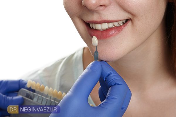 کی نباید کامپوزیت کنیم دندان مناسب برای ونیر کامپوزیت چه کسانی نباید کامپوزیت کنند