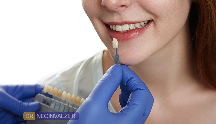 کی نباید کامپوزیت کنیم دندان مناسب برای ونیر کامپوزیت چه کسانی نباید کامپوزیت کنند
