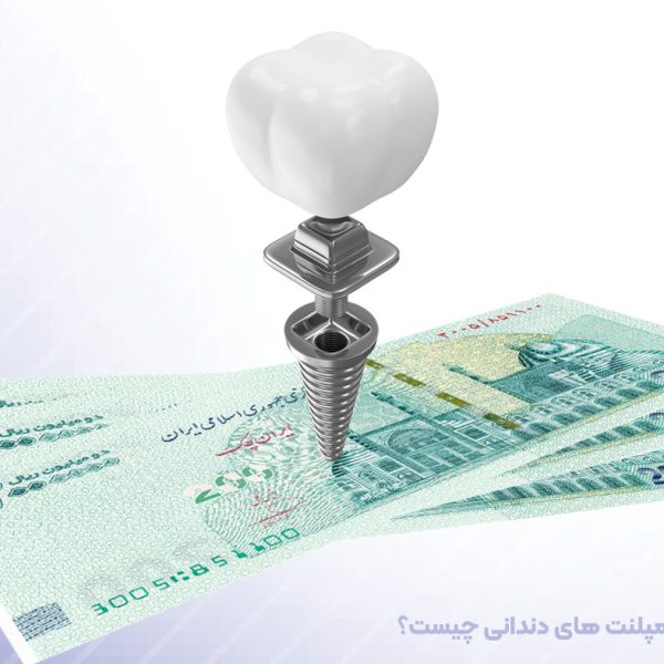 مقایسه برندهای مختلف ایمپلنت دندان از نظر قیمت و کیفیت و تفاوت قیمت ایمپلنت در تبریز