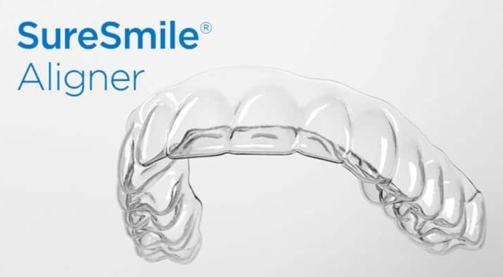 الاینر های شفاف در ارتودنسی SureSmile® Clear Aligners
