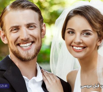 بلیچینگ دندان قبل از عروسی در تبریز و تصویر لبخند عروس و داماد بعد از بلیچینگ در تبریز