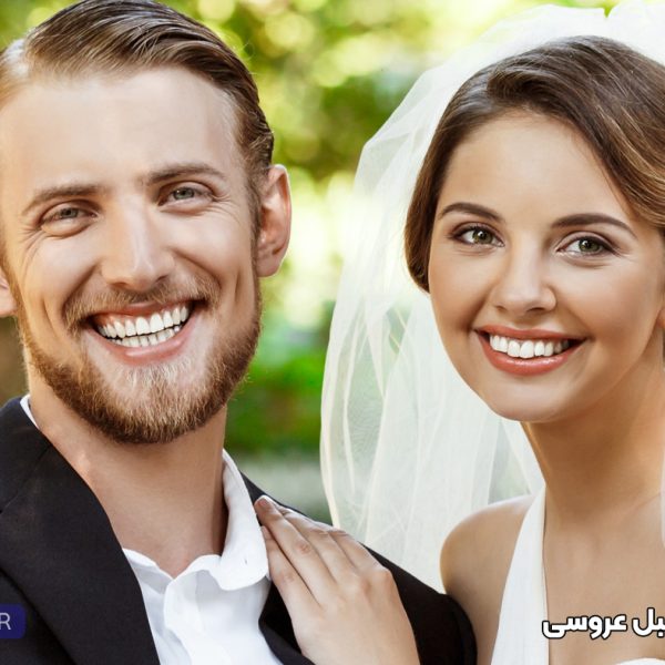 بلیچینگ دندان قبل از عروسی در تبریز و تصویر لبخند عروس و داماد بعد از بلیچینگ در تبریز