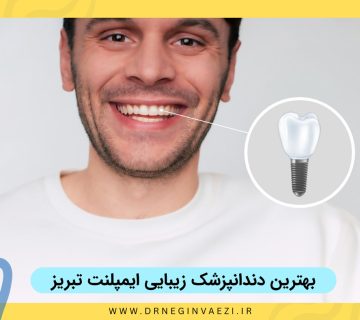 بهترین دندانپزشک زیبایی ایمپلنت تبریز دکتر نگین واعظی و معرفی بهترین روکش های ایمپلنت