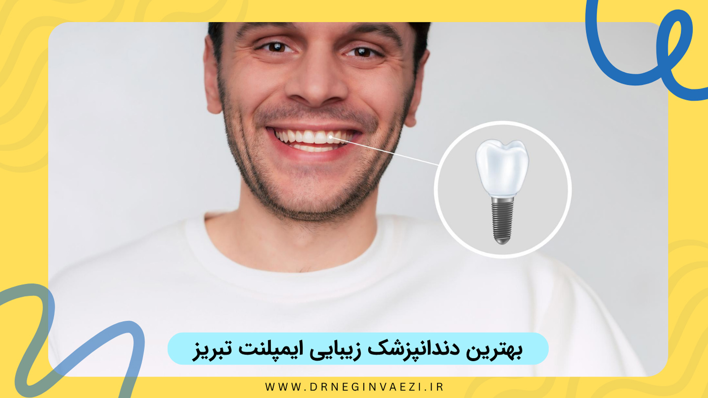 بهترین دندانپزشک زیبایی ایمپلنت تبریز دکتر نگین واعظی و معرفی بهترین روکش های ایمپلنت